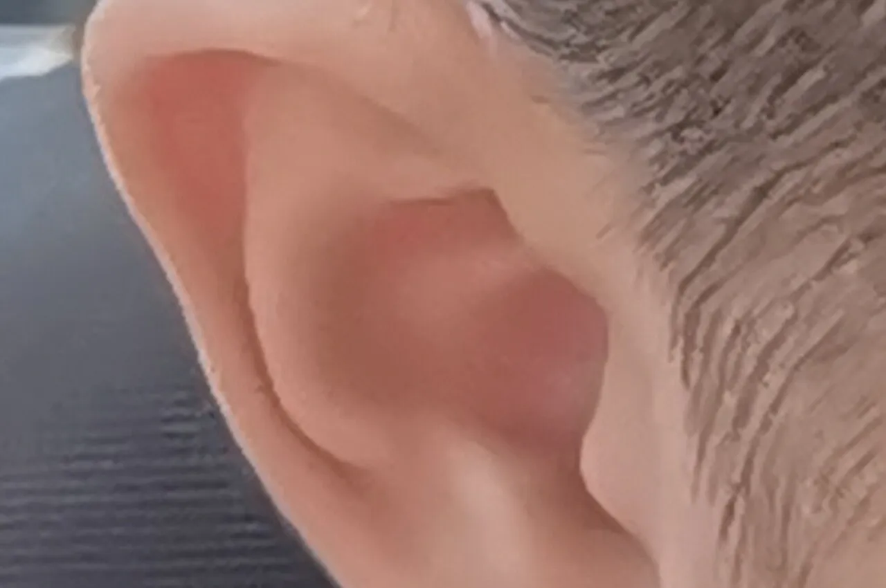 Gros plan sur le pavillon d'une oreille, vu de profil, devant un fond sombre